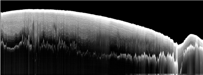 HiCARS radar profile